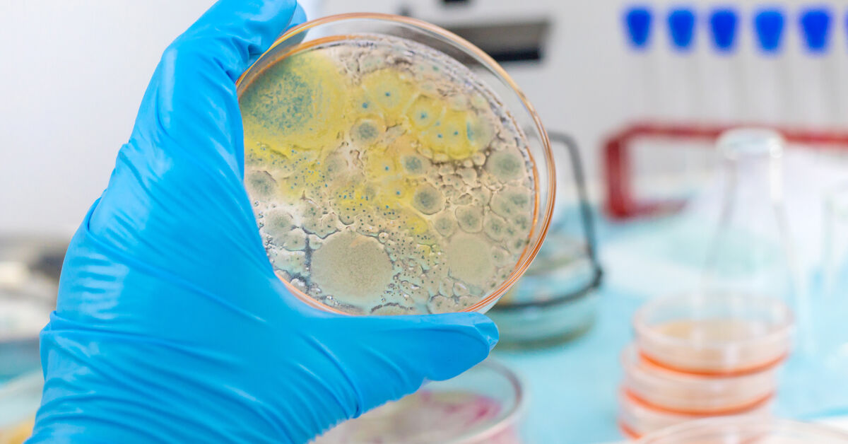 Bacteria colonies growing in petri dish